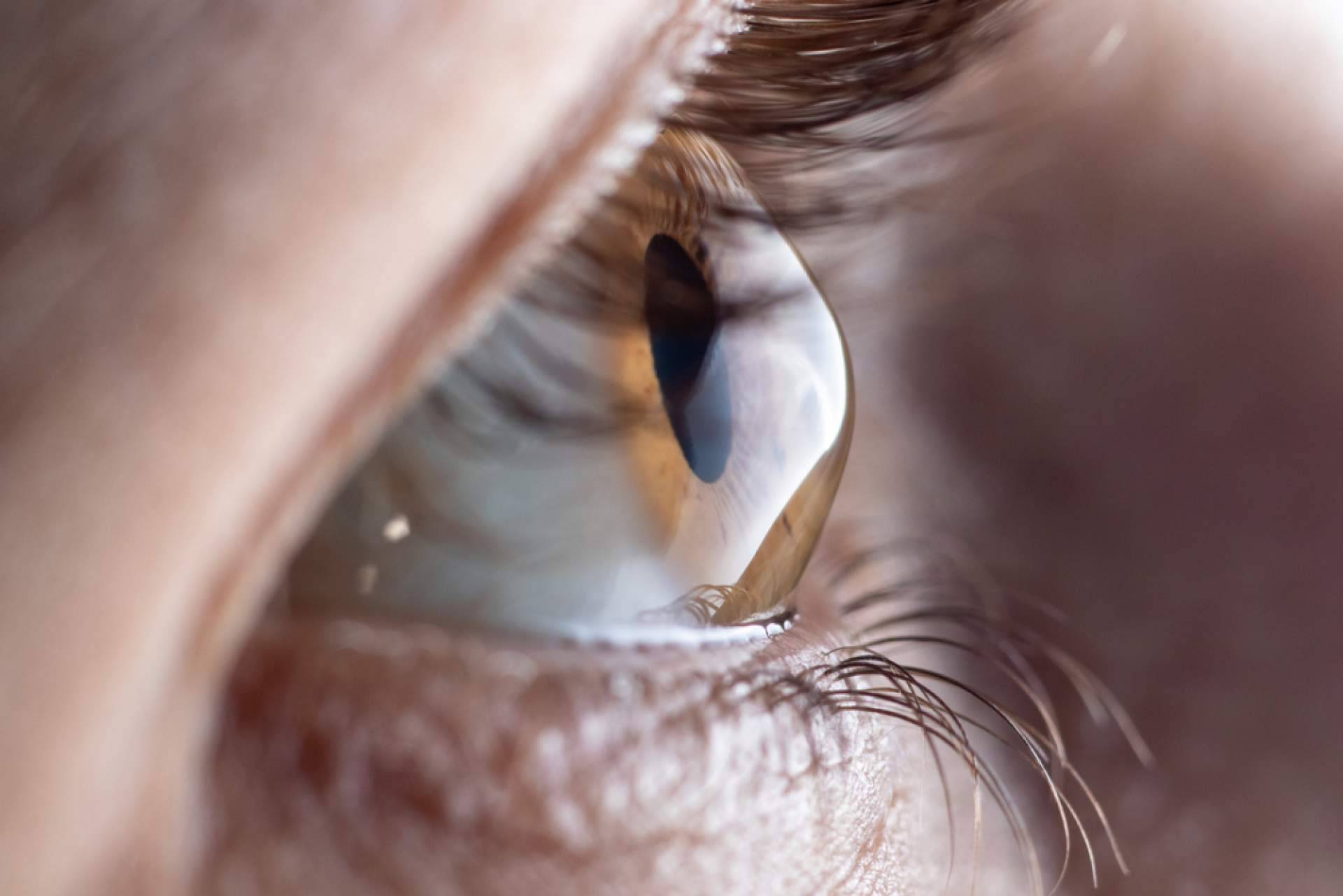 Eliminar de forma definitiva el uso de gafas o lentillas en el Departamento de Oftalmología del Instituto Universitario Dexeus