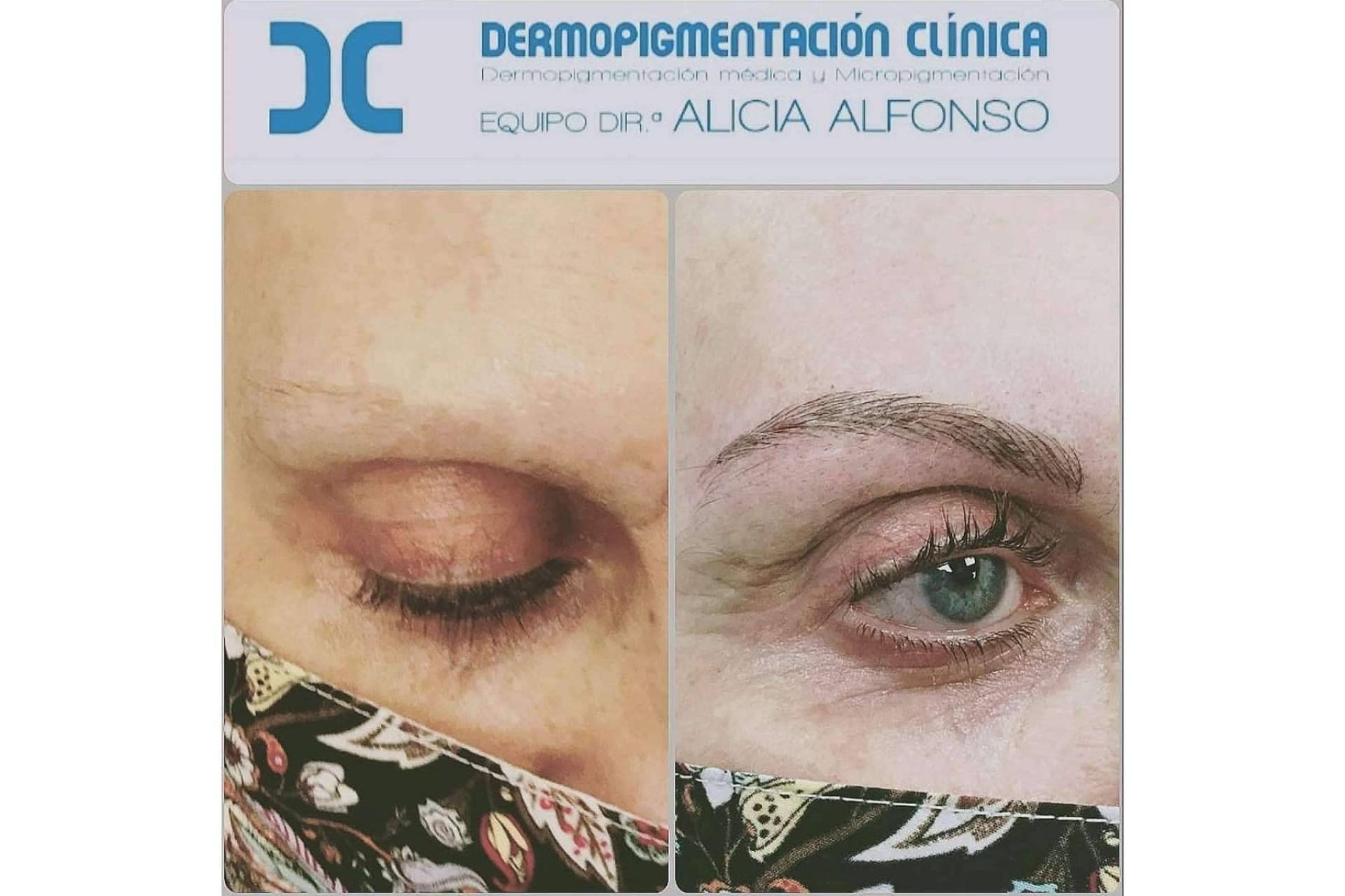 La micropigmentación y microblading y sus principales diferencias
