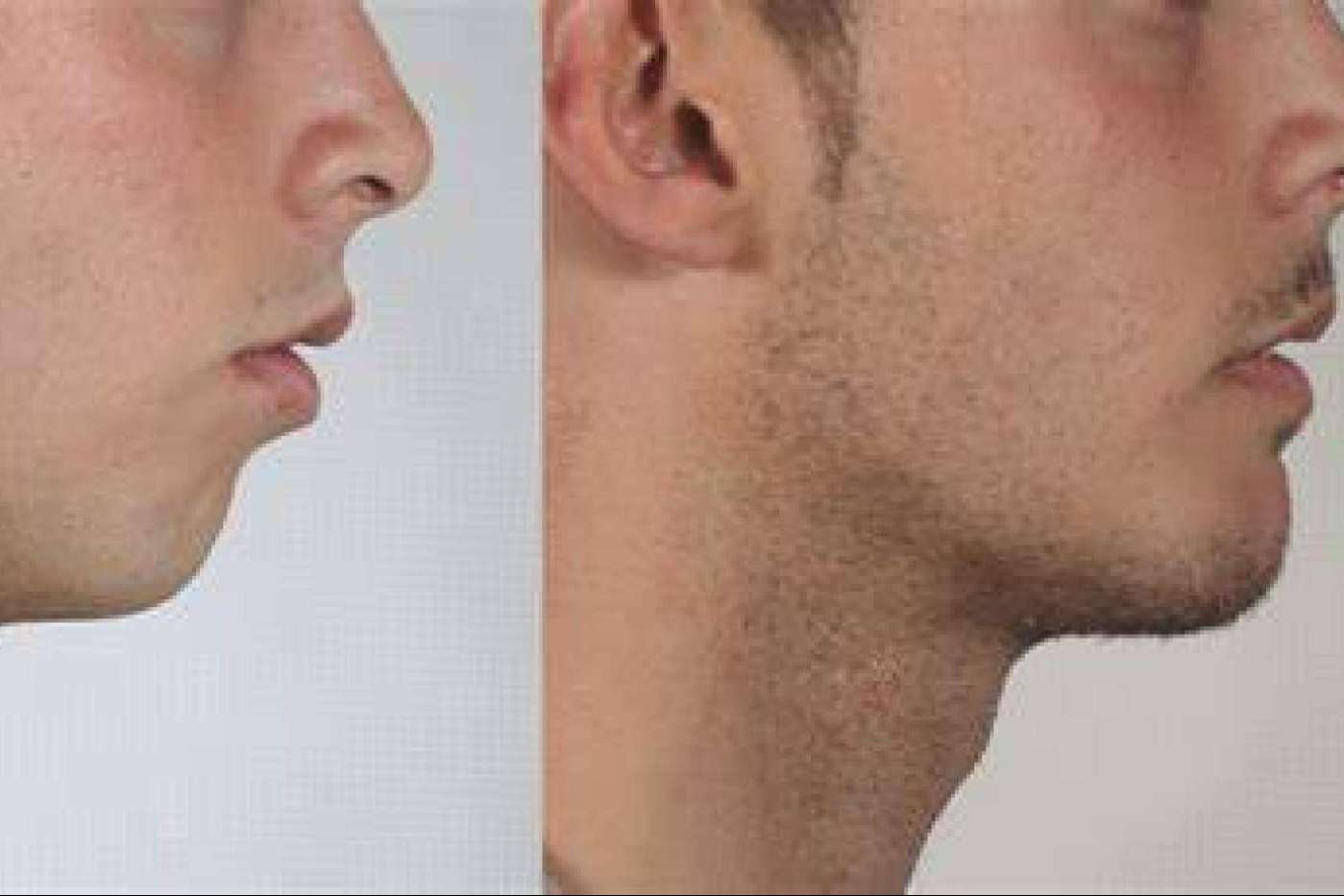 Clínica maxilofacial especializada en cirugías ortognáticas, Clínica Calvo de Mora