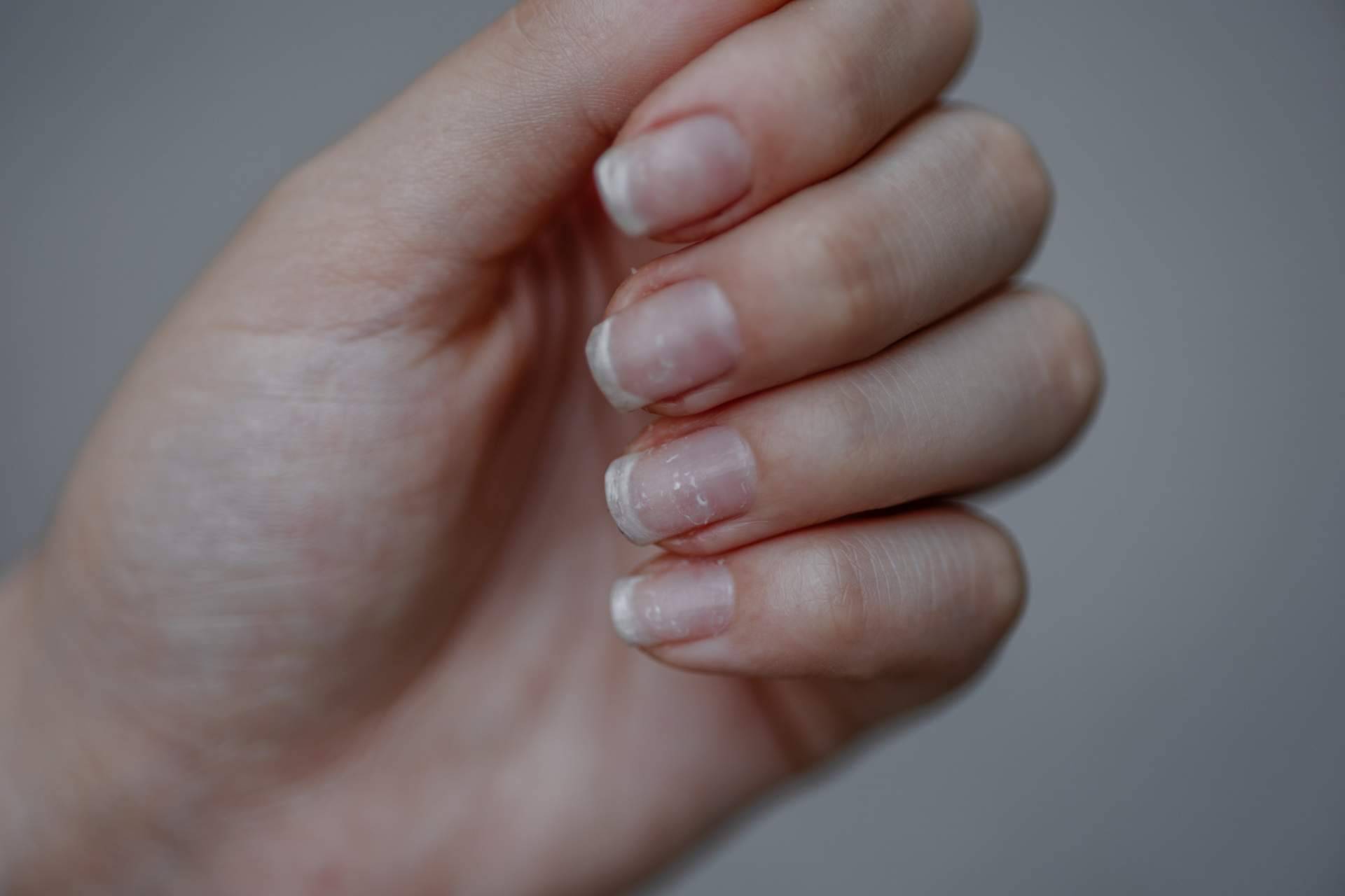El tratamiento holístico de uñas y cutículas, Lazonail®