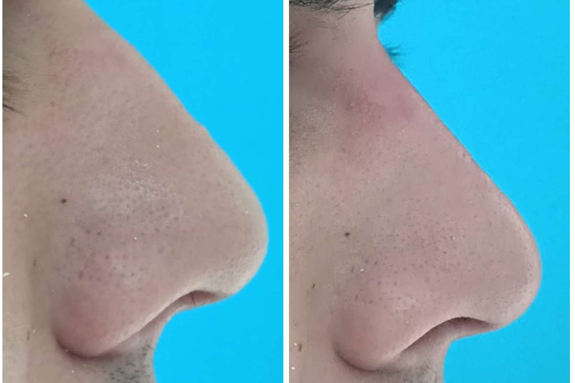 Medicina estética facial y dental para una sonrisa perfecta de la mano de Clínica Calvo de Mora