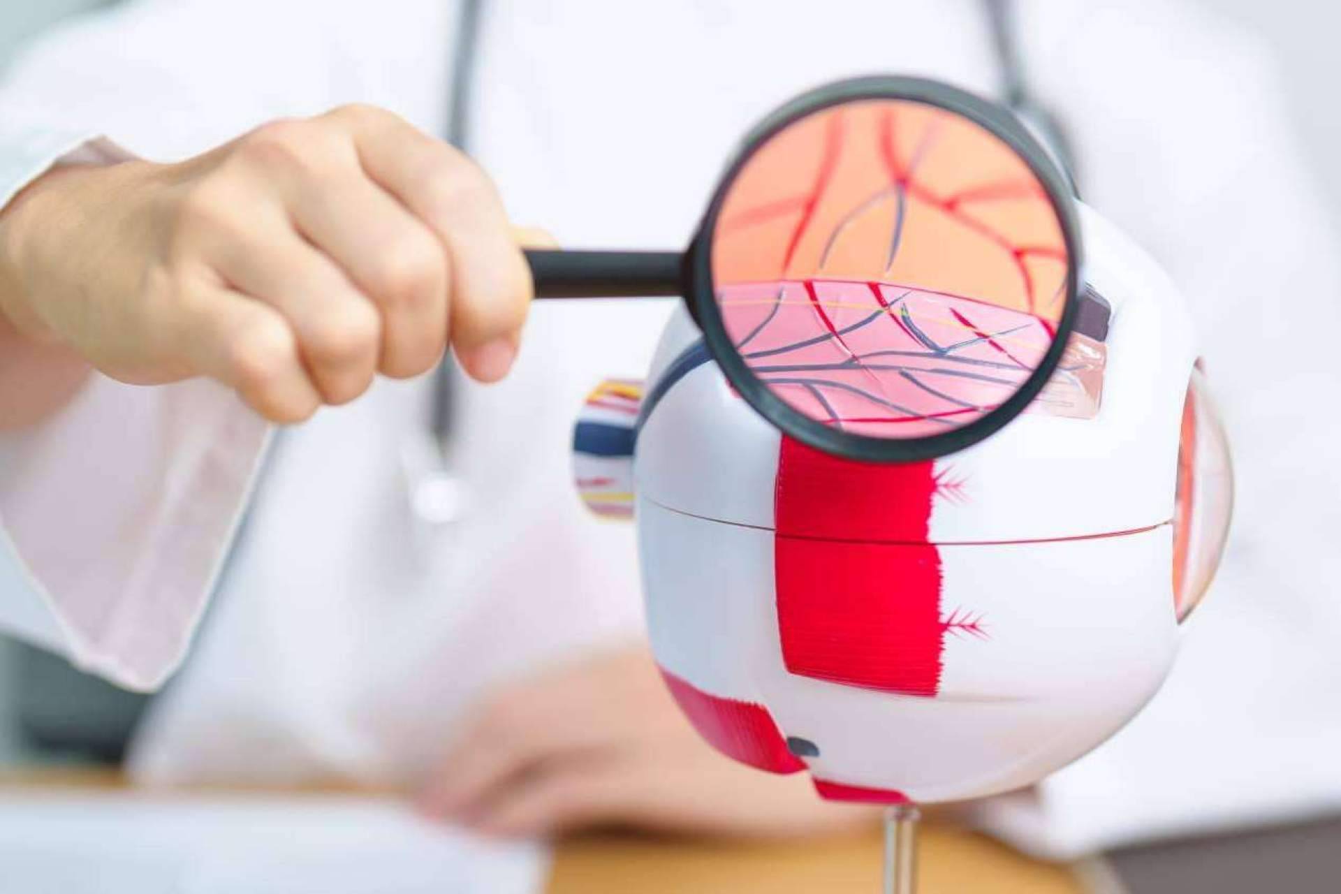 El Departamento de Oftalmología del Instituto Universitario Dexeus explica en qué consiste la retinopatía diabética