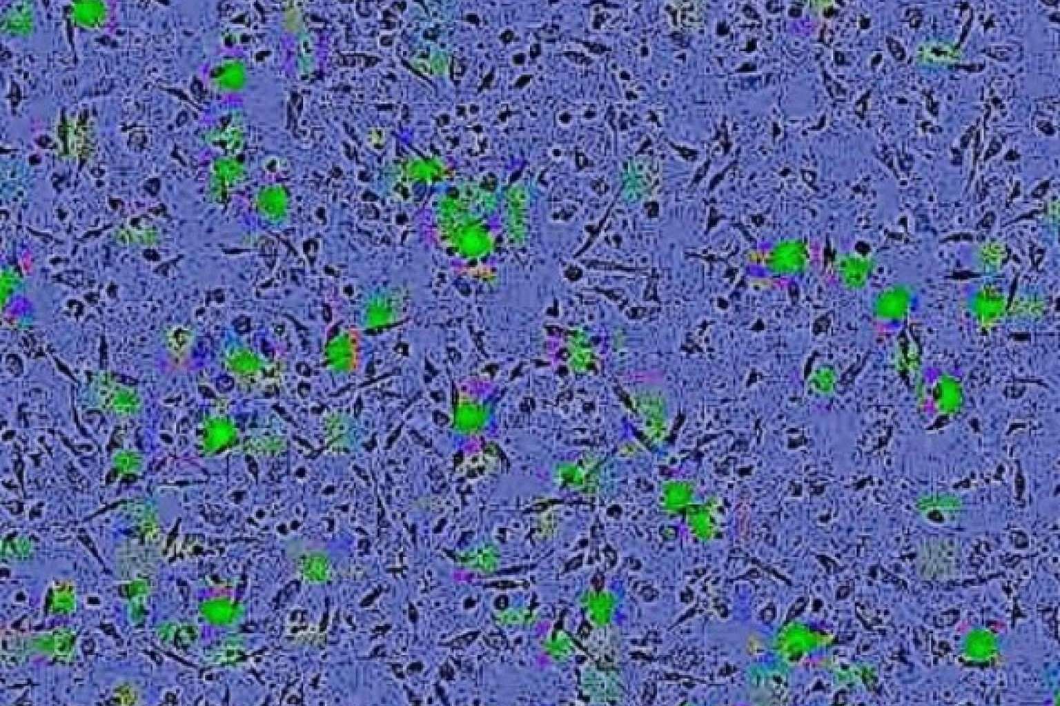 Oncovix; Inmunoterapia de Precisión, un Hito en la Revolución del Tratamiento del Cáncer