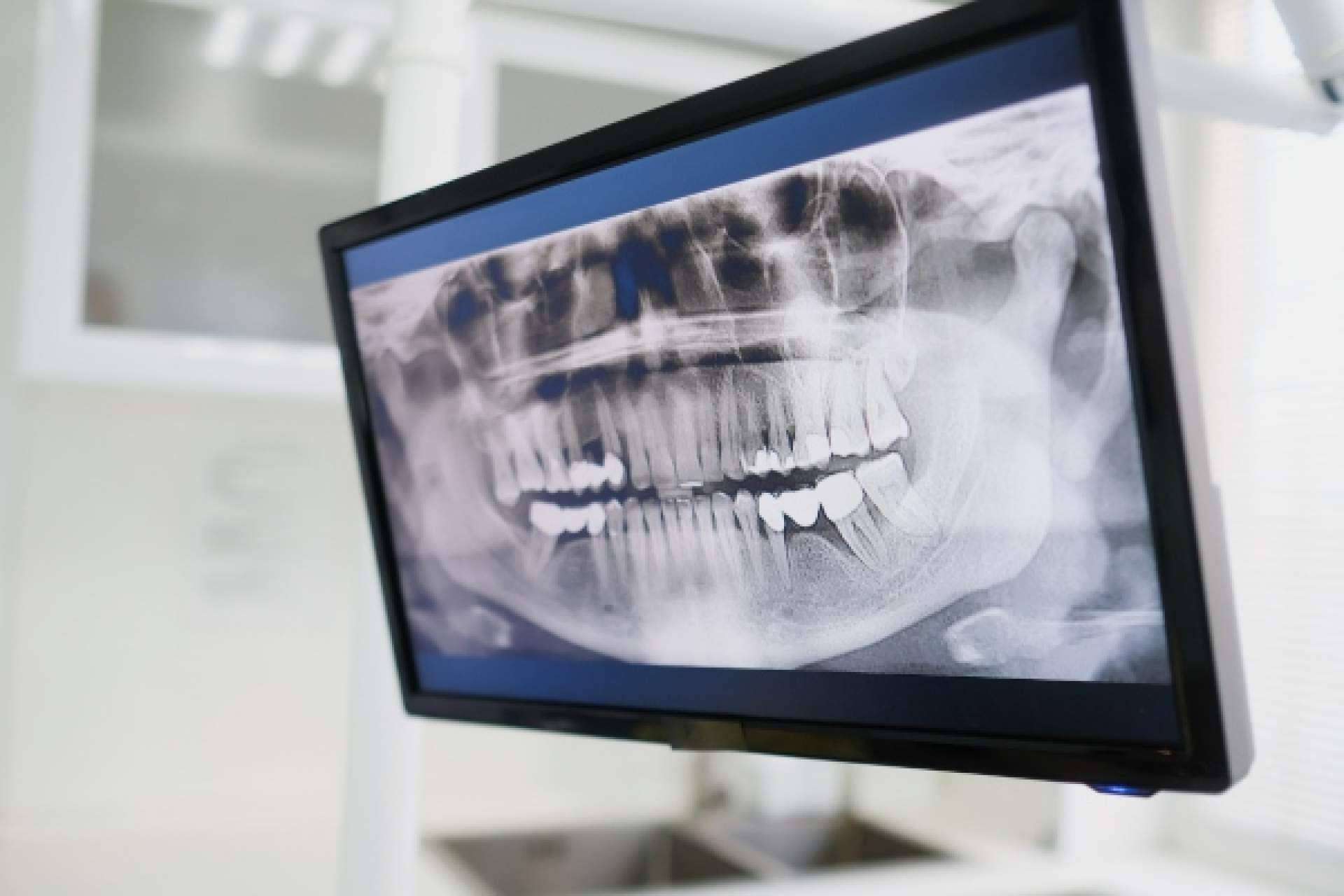 Servicios de odontología avanzada en Madrid, de la mano de Denty Dent