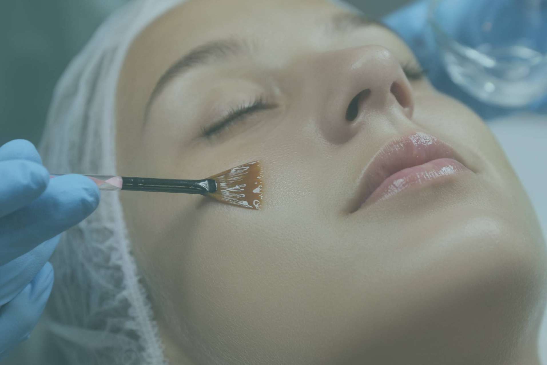La Dra. Cecilia Arthur es especialista en peeling químico en Madrid
