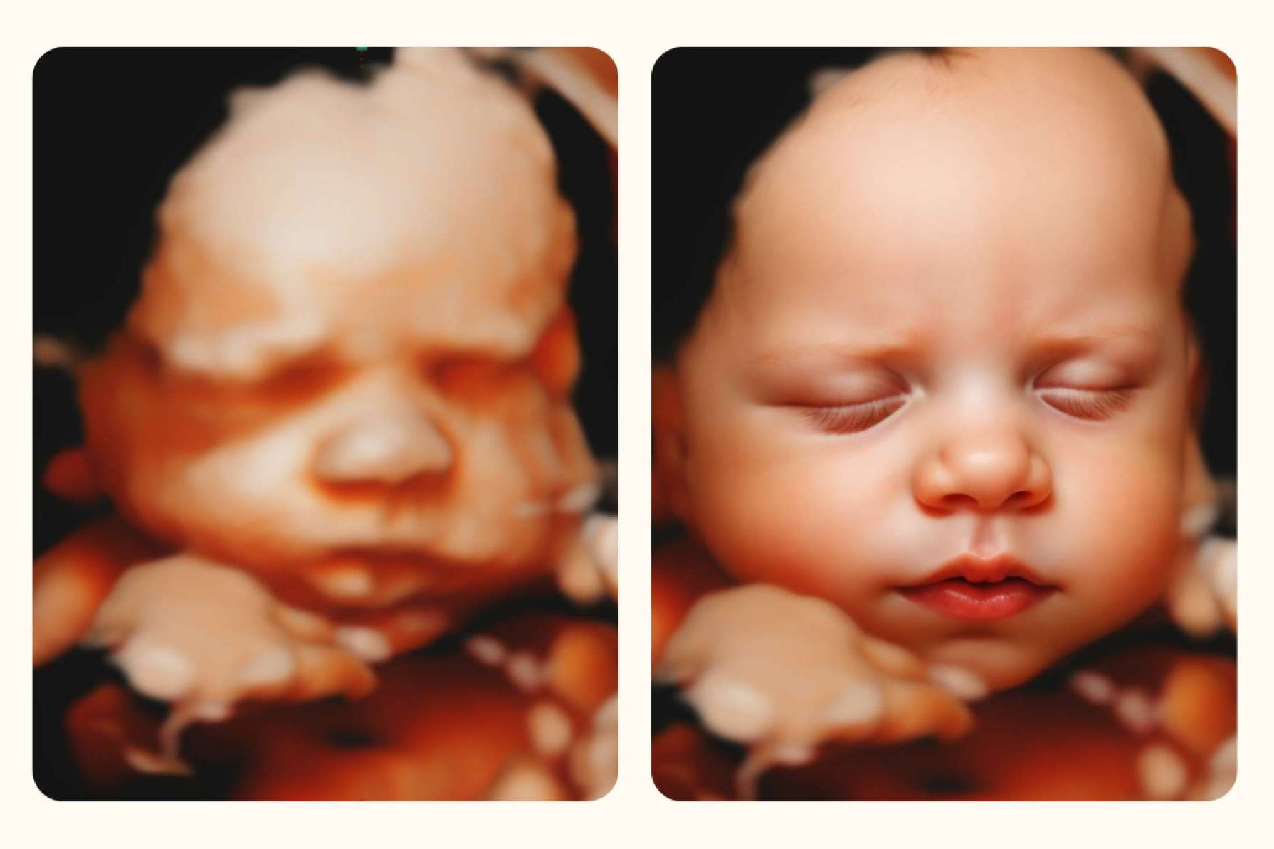 Ecox revoluciona la ecografía emocional para futuros padres