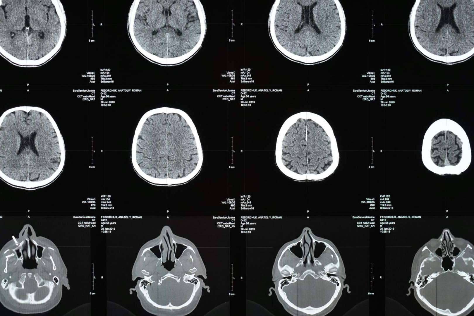 Radiología que salva vidas; el impacto clínico de la Dra. Claudia Martínez Higueros