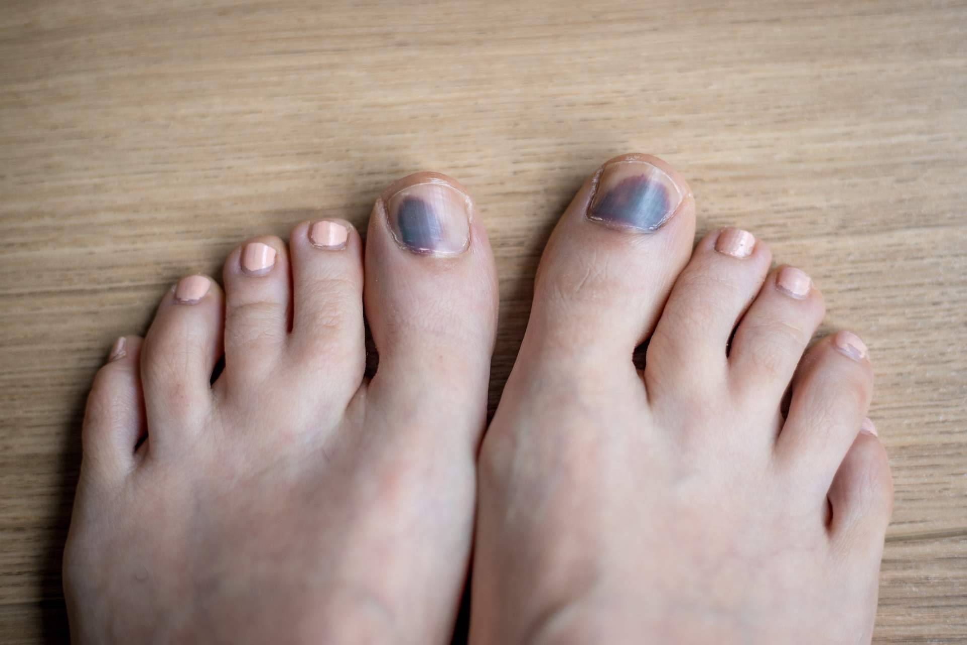 ¿Se sabía que el dolor de espalda puede venir de cómo apoyan los pies?
