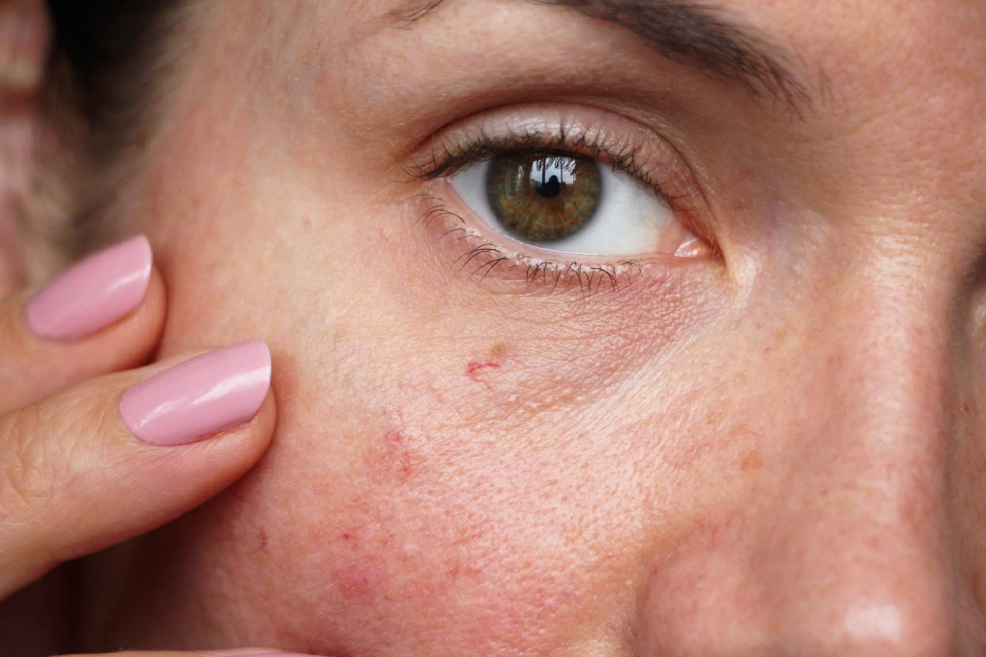 Evoderm, dermocosmética avanzada para el cuidado de la piel con fórmulas limpias, efectivas y avaladas por expertos