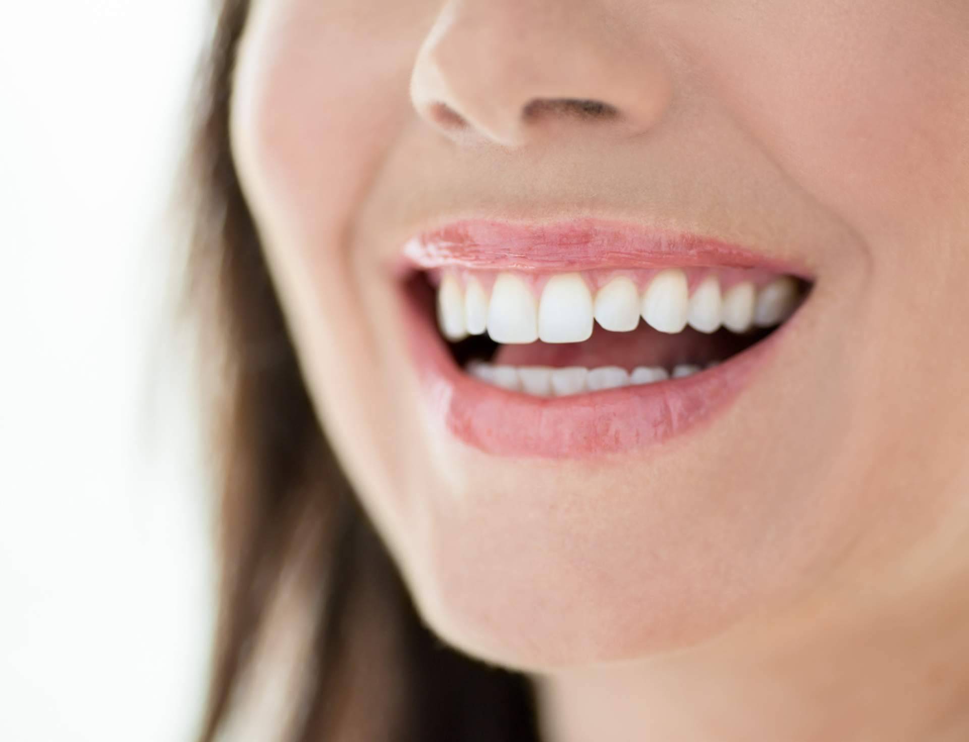 Innovación en carillas dentales sin dañar el diente en Clínica Dental Calvo de Mora