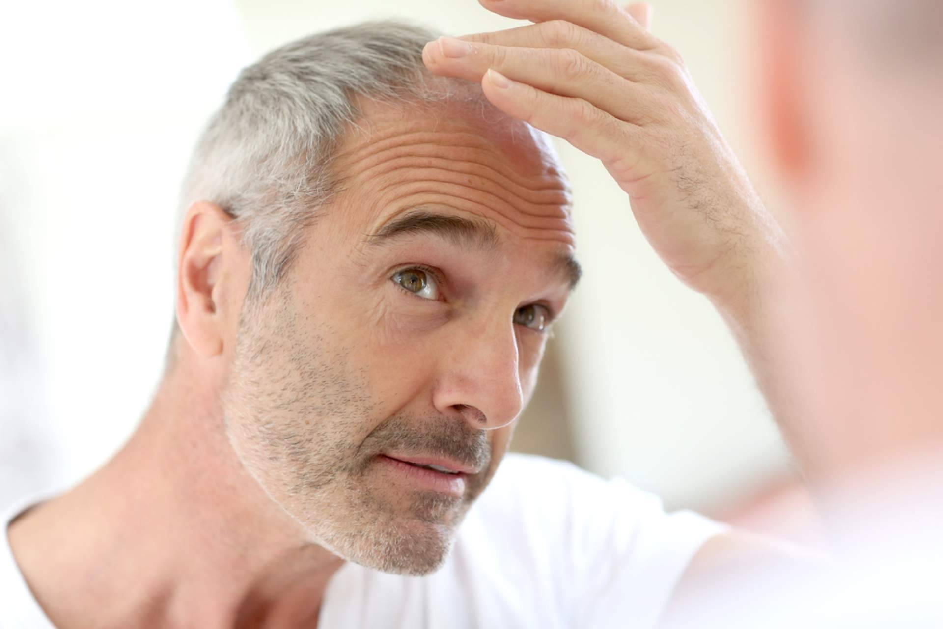 El cuidado post trasplante capilar protagoniza la oferta especializada de HairFluencer