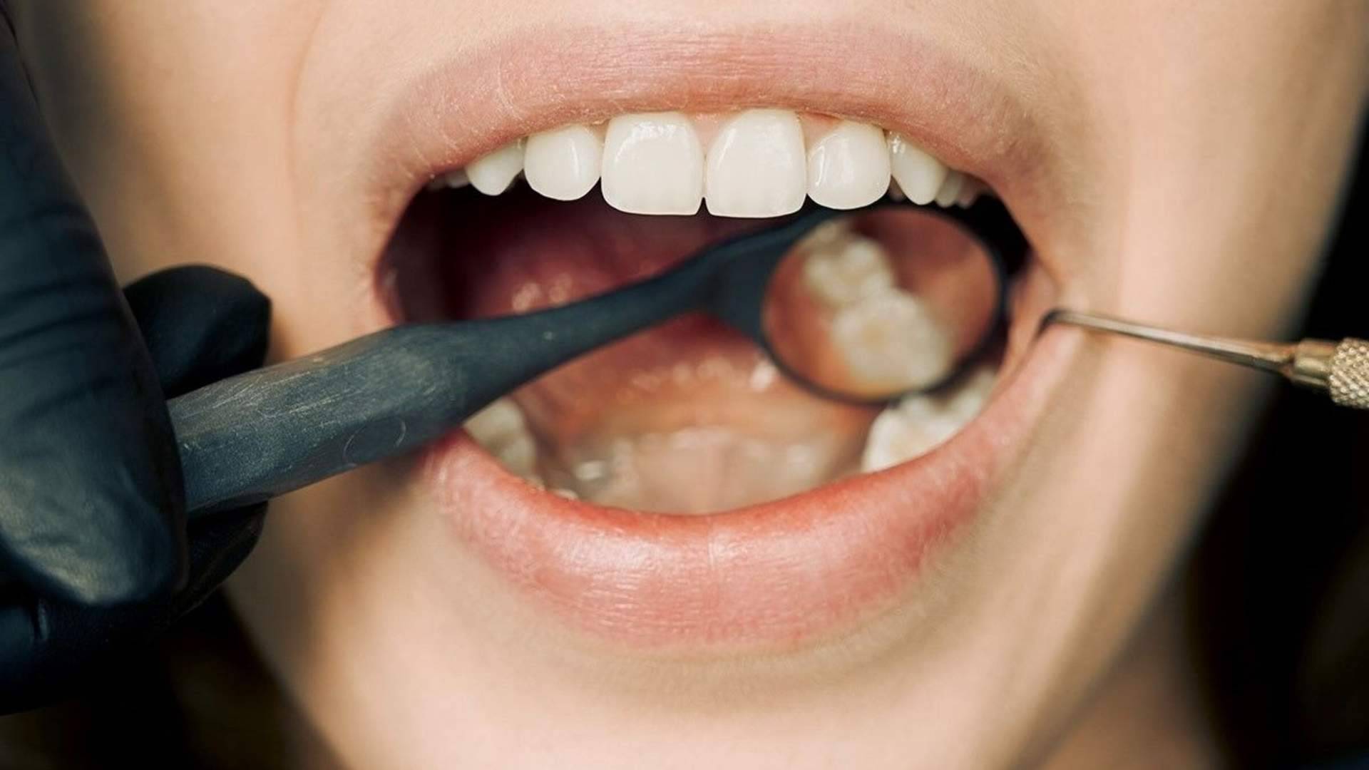 Clínica Dental Jorge del Corral impulsa la estética dental con carillas y prótesis fija de cerámica sin metal